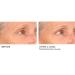 NassifMD Pro Peptide Collagen Serum | Anti-Aging Treatment for Fine Lines Wrinkles & Textured Skin - Firm & Smooth Your Skin - Buy Online on GoSupps.com