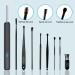 WiFi Ear Wax Remover with Endoscope Camera - 12pcs Ear Spoon Kit for iOS & Android - Buy Online on GoSupps.com