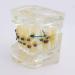 Dental Orthodontic Model Oral Cluttered Teeth Pattern with Ceramic Supports for Studying The Anti-jaw Protrusion Opening of The jaw - Buy Online on GoSupps.com