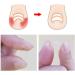 Toenail Tool 6 in 1 Ingrown Toe Nail Fixer Pedicure Toenail Recover Nail Foot Care Kit Ingrown Toenail Corrector for Men Women(24pcs) - Buy Online on GoSupps.com