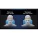 Cervical Traction Device for Neck & Shoulder Relief | Restore Spine Curvature & Relaxation | International Shipping Available - Buy Online on GoSupps.com