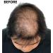 Super Million Hair 1 x 25g Hair Building Fibers Auburn No. 8 - Buy Online on GoSupps.com