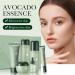 Avocado Skin Care Set Skin Care Kit with Facial Cleanser Toner Serum Lotion Cream Eye Cream Anti-Aging Smooth Hydrating Skin Care Kit For Women Men - Buy Online on GoSupps.com
