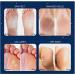 Aliceva One Step Foot Peel Mask - Exfoliating Callus Remover | 2 Pairs - Buy Online on GoSupps.com