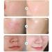 Hyalu B5 Serum 10 Sheet Mask Multi-effect Repair Mask Moisturizing and Soothing Skin Diminishing Acne Marks Beauty Mask For All Skin Care Type - Buy Online on GoSupps.com