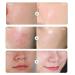 Hyalu B5 Serum Sheet Mask - Multi-Effect Moisturizing & Soothing Beauty Mask for All Skin Types | Diminish Acne Marks - Buy Online on GoSupps.com