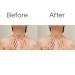 Anti-Aging Silicone Neck & Chest Wrinkle Patches - Skin Firming & Moisturizing Treatment | Reusable Overnight Smoother for Decolletage - 1 Pack - Buy Online on GoSupps.com