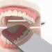 Buy 5pcs Dental Photography Mirrors Kit - 2-Sided Intraoral Reflector & Mouth Speculum for Clinics | International Shipping Available - Buy Online on GoSupps.com