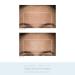NuFACE Trinity Complete facial toning kit - Achieve firmer, lifted skin - Buy Online on GoSupps.com
