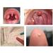Airgoesin Tonsil Stone Remover Kit - 2 Sets with LED Tool, Irrigation Syringe, Stainless Tonsil Pick - Yellow+Pink - Buy Online on GoSupps.com
