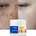 2024 new Crema Para Manchas Oscuras En La Cara 50g Contain Collagen & Hyaluronic acid Face Moisturizer Cream Adecuado para varias reas como cara axilas cuello zona privade (1pcs) 1 Ounce (Pack of 1) - Buy Online on GoSupps.com