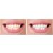 Smile Sciences Premium Teeth Whitening Pens - Carbamide & Hydrogen Peroxide Formula for Brighter Smile, No Sensitivity - Travel-Friendly Peppermint Whitening Pen - Buy Online on GoSupps.com
