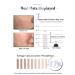 TRUU Intensive Dark Spot Corrector 30ML - Effective Skincare for All Skin Types | Fast International Shipping - Buy Online on GoSupps.com