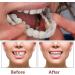 Brigtviee 2 Pairs Instant Veneers Dentures False Teeth Braces Whitening Cosmetic ClickOn Tooth Covering Clipin Veneer Teeth Temporary Smile Upper and Lower False Teeth - Buy Online on GoSupps.com