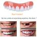Upgrade Your Smile with Instant Cosmetic Snap-On Perfect Smile Teeth Whitening Denture Paste Brace - Buy Now! - Buy Online on GoSupps.com