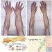 JDCP Lymph Drainage Magnetic Bracelet - Detox & Weight Loss Support in White & Rose Gold - Buy Online on GoSupps.com