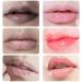 JINSHANE Lip Serum JINSHANE Dark Lip Treatment JINSHANE Korean Lip Serum JINSHANE Lip Lightening Moisturizing Nourishing Essence (2) - Buy Online on GoSupps.com