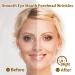 Forehead Wrinkle Patch - Reusable Anti-Wrinkle Treatment | Overnight Skin Care | Pack of 3 - Buy Online on GoSupps.com