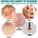 Premium 20% Benzocaine Numbing Spray - Topical Anesthetic for Pain Relief | Cuts Burns Scrapes Waxing & Insect Bites | USA Made - 2x2oz - Buy Online on GoSupps.com