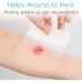 Adaptic Wound Contact Layer - Non-Adhering Silicone Dressing Pad for Bedsores Leg Ulcers Burns & Skin Tears - 4"x4" Pack of 10 - Non-Adhesive Primary Bandages - Buy Online on GoSupps.com