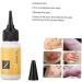Delicate Skin Scar Treatment Serum - Acne Scar Removal & Repair Cream - 20ml - Buy Online on GoSupps.com