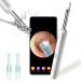 Ear Wax Removal Endoscope Otoscope Earwax Remover Tools Ear Wax Picker with 1080P FHD Camera 6 Led Lights Wireless Connected Compatible with iPhone iPad Android Smart Phones & Tablets