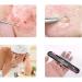 Beautyh Comedone Quicker Stainless Steel Acne Extractor Kit - Effective Blackhead Remover Set - Buy Online on GoSupps.com