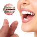 300PC Orthodontic Rubber Bands & Bracelets - Elastic Dental Tools for Teeth Alignment | International Shipping - Buy Online on GoSupps.com