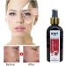 ican London 100% Organic Rosehip Oil For Hair Nails And Skin 150ml - Buy Online on GoSupps.com