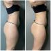 GUAM Seaweed Mud Body Wrap 1KG + Anti-cellulite Gel 250ml Set - Cellulite Remover & Treatment Kit - Buy Online on GoSupps.com