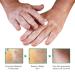 VitiligoFix Revitalize Elixir: Psoriasis Relief Cream & Moisturizer for Skin, Natural White Spot Remover (2Pcs) - Buy Online on GoSupps.com