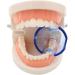 Buy Wudaizhi 5pcs Dental Mouth Retractor Tube Expander - Blue Mouth Opener for Clinics & Oral Care - Fast International Shipping - Buy Online on GoSupps.com