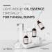 La Theorie Moisturizing Oil Essence for Troubled Skin | Fungal Bumps Relief | Fatty Acid Free | 1.01 Fl Oz - Shop Internationally - Buy Online on GoSupps.com