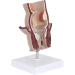 Medical Science Rectum Fissure Lesion Model 5X Human Pathology Model Hemorrhoid Anal Fistula Medical Organ Model - Buy Online on GoSupps.com