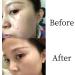 SIPORY Herbal Skin Cleanup Ointment - Huangfutang Concentrated Removal Cream (3pc) - Buy Online on GoSupps.com