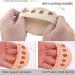 Soleful Solutions High Heel Metatarsal Pads & Invisible Toe Socks (5Pairs Beige) - Buy Online on GoSupps.com