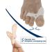 Silicone Toe Correctors & Relief for Hallux Valgus - Hammer Toe Separator & Spacer - International Shipping Available - Buy Online on GoSupps.com