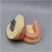 Fhuili Dental Implant Practice Model - Gum-Free Distental Model for Advanced Training - Buy Online on GoSupps.com