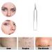 GNAUMORE Blemish Remover Stainless Steel Blackhead Remover Tool Acne Whitehead Blemish Remover Kit 1PC - Buy Online on GoSupps.com