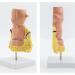 Human Anorectal Pathology Model Hemorrhoid Lesion Model Proctology Hemorrhoid Anal Fistula Lesion Model for Medical Teaching/Education Supplies - Buy Online on GoSupps.com