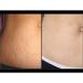 Frank Body Coconut Coffee Scrub 100g - Exfoliating Body Scrub for Glowing Skin | International Shipping Available - Buy Online on GoSupps.com