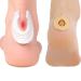 Felt Callus Pads 6 Pieces & Foam Callus Cushions 45 Pieces Soft Foam Callus Cushions Toe Pads Provides Cushioning Protection Corn Cushions
