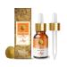 Crysalis Rice Bran (Oryza Sativa L.) Oil | Pure & Natural Undiluted Cold Pressed Carrier Oil - 30ml/1.01fl oz Rice Bran 30 ml (Pack of 1)