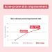 ZEROID Pimprove Calming Ampoule | Korean Dermocosmetic Balance Care for Oily & Troubled Skin (30ml) - Buy Online on GoSupps.com