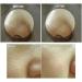 Vegan Beauty Blackhead & Whitehead Remover - BONAJOUR Sebum Cleansing Gel | Deep Pore Cleanse with Natural Ingredients - 3.5 fl. oz - International Shipping - Buy Online on GoSupps.com