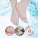 Zhangl Massage Foot Corn Remover - 20 Boxes of Effortless Feet Care & Massage for Healthy Feet - Buy Online on GoSupps.com