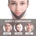 Adjustable Anti-Snoring Chin Strap for CPAP Users | Breathable & Comfortable Sleep Device for Men & Women - Buy Online on GoSupps.com