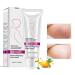 Stretch Marks Cream scar cream scar cream removal cream body repair cream strain strip repair body skin moisturzing for women after pregnancy 40g