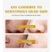 Gel Exfoliant Gommage Au Gel Exfoliant Nettoyant Visage Blanchiment Gommant pour Visage Gommage Hydratant Blanchissante Cr me Gels Peeling Exfoliants claircissant - Buy Online on GoSupps.com