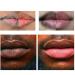 Magic Lip Lighten Scrub - Dark Lip Removal Exfoliate & Brighten for Moisturized Pink Lips - Buy Online on GoSupps.com